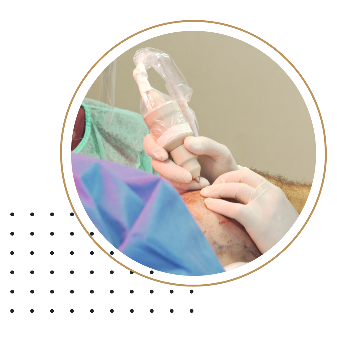BotHair® ULtraPlus